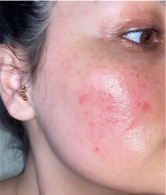 Eleisa's before image