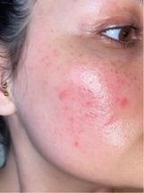 Eleisa's before image